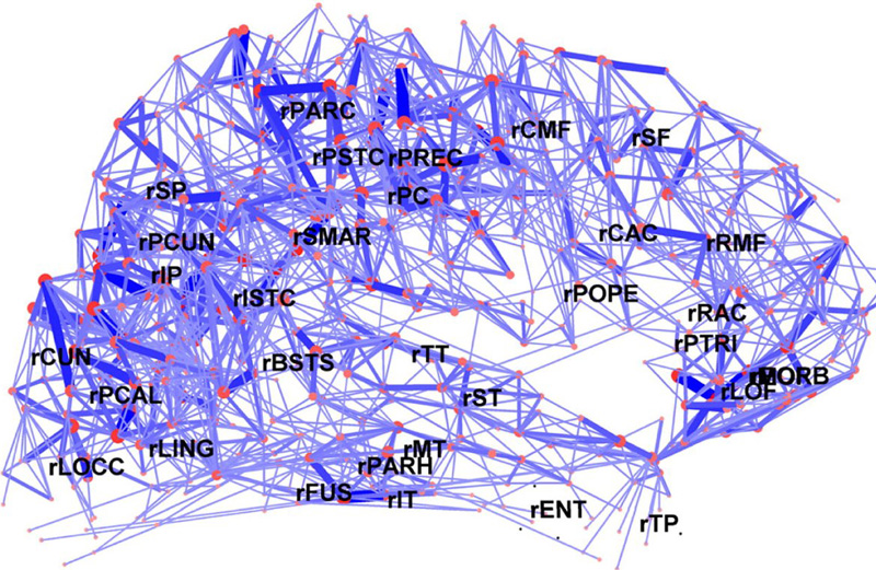 Illustration for article titled First Look at the "Structural Core" of the Human Brain